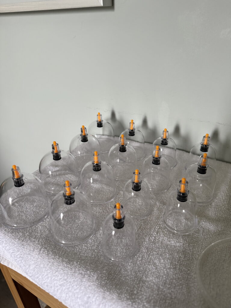 cupping therapy in Point Pleasant New Jersey